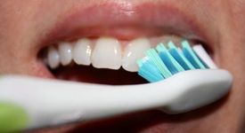 Каква четка за зъби да използваме - електрическа или класическа?