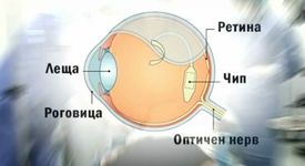 Имплантиран чип помага на незрящи да четат