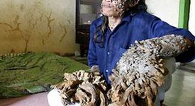 Невероятни загадки на човешкия организъм - 1 част