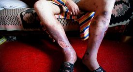 Ужас! Появи се нов смъртоносен наркотик, наречен 'крокодил'