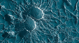 Състав и структура на клетъчната стена при архебактериите