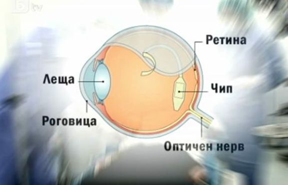 Имплантиран чип помага на незрящи да четат